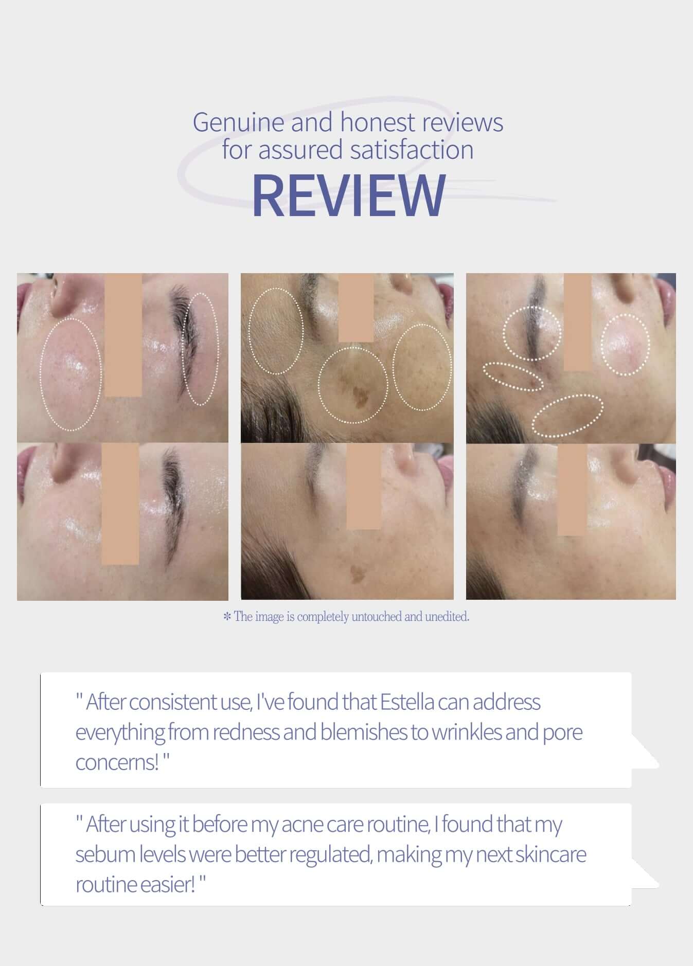 EstellaPRO Ultrasonic Skincare Aesthetic Equipment Machine - Korean Ultrasound Beauty Devices | Estella OfficialProfessional