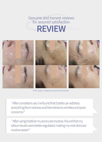EstellaPRO Ultrasonic Skincare Aesthetic Equipment Machine - Korean Ultrasound Beauty Devices | Estella OfficialProfessional